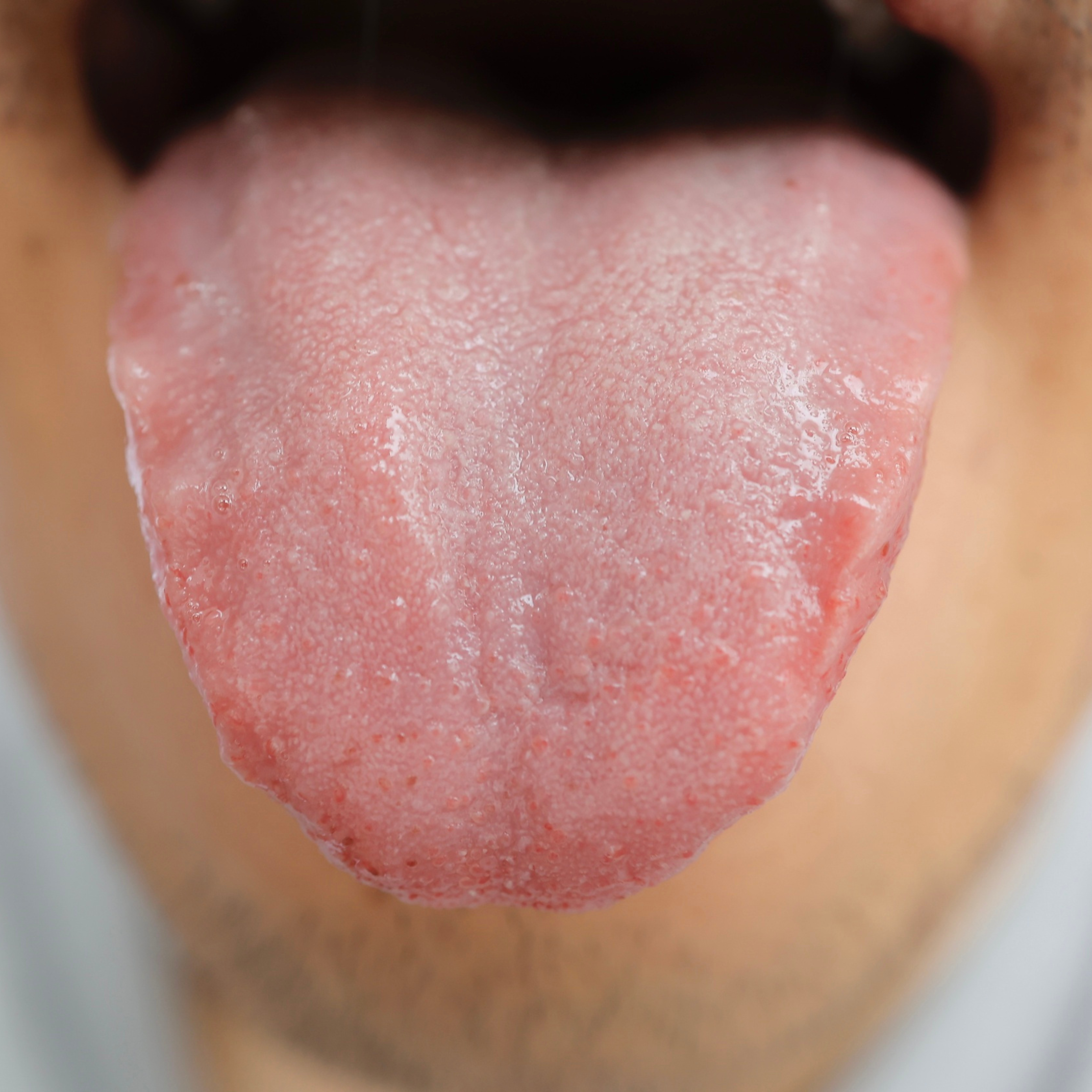 🌿 What Your Tongue May Be Telling You About Digestion and Energy